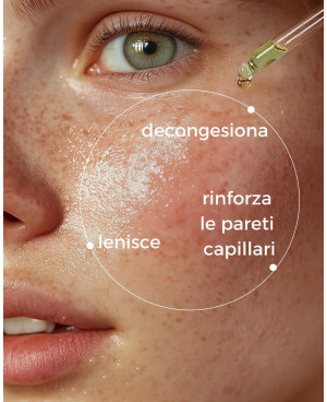 ROSSORI E COUPEROSE