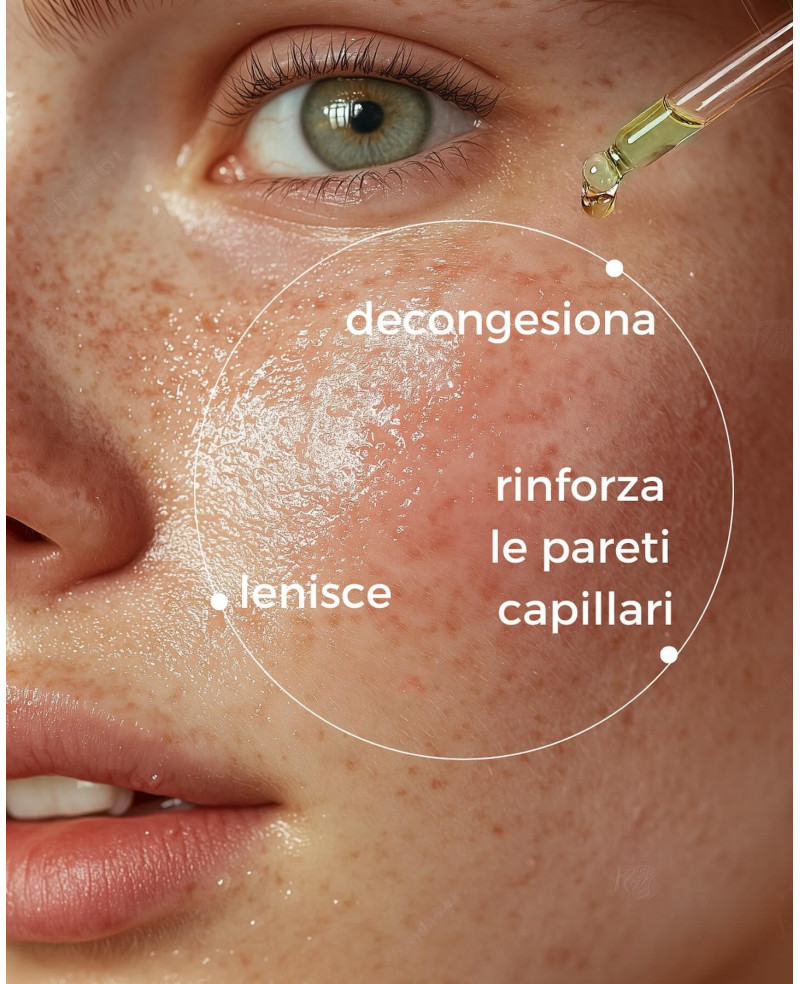 ROSSORI E COUPEROSE