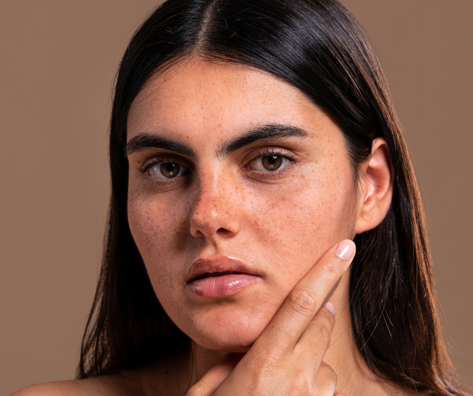 macchie-solari-viso-siero-schiarente-naturale